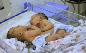 60-year-old Austrian woman gives rare birth to twins