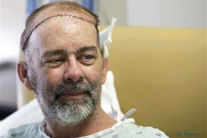 US: Doctors in Texas perform historic skull and scalp transplant surgery US: Doctors in Texas perform historic skull and scalp transplant surgery
